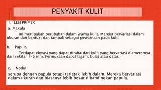 PENYAKIT KULIT
1. LESI PRIMER
a. Makula
ini merupakan perubahan dalam warna kulit. Mereka bervariasi dalam
ukuran dan bentuk, dan tampak sebagai pewarnaan pada kulit
b. Papula
Terdapat elevasi yang dapat diraba dari kulit yang bervariasi diameternya
dari sekitar 1-5 mm. Permukaan dapat tajam, bulat atau datar.
c. Nodul
serupa dengan papula tetapi terletak lebih dalam. Mereka bervariasi
dalam ukuran dan biasanya lebih besar dibandingkan papula.
 