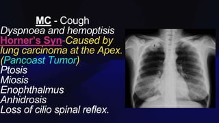 MC - Cough
Dyspnoea and hemoptisis
Horner’s Syn-Caused by
lung carcinoma at the Apex.
(Pancoast Tumor)
Ptosis
Miosis
Enophthalmus
Anhidrosis
Loss of cilio spinal reflex.
 