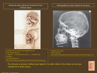 Visible sur le site :
http://www.ac-
grenoble.fr/disciplines/sti/biotec/articles.php?lng=fr&pg=130
A retrouver sur le site web gallery of art :
http://www.wga.hu/
« artists », « Leonardo da Vinci », « Anatomical
studies ».
ou directement ici :
http://www.wga.hu/art/l/leonardo/10anatom/2head3.jpg
Dessin de crâne réalisé par Léonard de Vinci
XVIème siècle
•Les dessins sont assez réalistes par rapport à la radio, même si les crânes ne sont pas
orientés de la même façon.
Radiographie de crâne réalisée de nos jours
 
