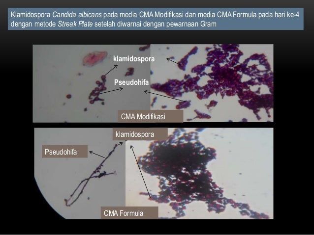 Perbandingan Kualitas Preparat Klamidospora Candida Albicans Yang Ter