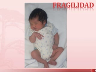 fragilidad