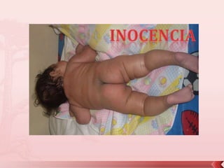 inocencia