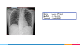 Loopografi Normal Radiologi Ppt Radiologi normal dan abnormal-ahp.pptx