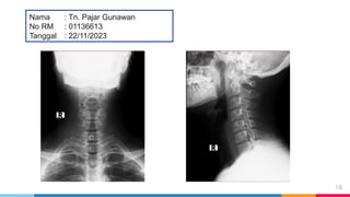 Loopografi Normal Radiologi Ppt Radiologi normal dan abnormal-ahp.pptx