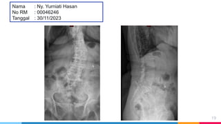 Loopografi Normal Radiologi Ppt Radiologi normal dan abnormal-ahp.pptx