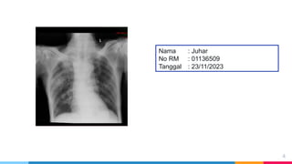 Loopografi Normal Radiologi Ppt Radiologi normal dan abnormal-ahp.pptx