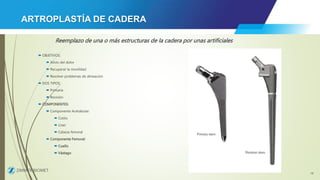 cadera.pptx