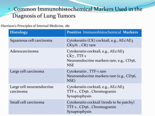  Common Immunohistochemical Markers Used in the

Diagnosis of Lung Tumors
:Harrison's Principles of Internal Medicine, 18e

Histology

Positive Immunohistochemical Markers

Squamous cell carcinoma

Cytokeratin (CK) cocktail, e.g., AE1/AE3
CK5/6 , CK7 rare

Adenocarcinoma

Cytokeratin cocktail, e.g., AE1/AE3
CK7 , TTF-1
Neuroendocrine markers rare, e.g., CD56,
NSE

Large cell carcinoma

Cytokeratin , TTF-1 rare
Neuroendocrine markers rare (e.g., CD56,
NSE)

Large cell neuroendocrine
carcinoma

Cytokeratin cocktail, e.g., AE1/AE3
TTF-1 , CD56 , Chromogranin
Synaptophysin

Small cell carcinoma

Cytokeratin cocktail (tends to be patchy)
TTF-1 , CD56 , Chromogranin
Synaptophysin

 