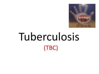Tuberculosis
(TBC)
 