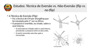 • A Técnica de Eversão (Flip)
• Foi a técnica de CM por ShangRing que
foi estudada pela 1ª vez na África.
• O prepúcio é evertido, ou virado, sobre o
anel interno.
• O anel externo é fixado sobre o anel interno,
prendendo o prepúcio entre os dois anéis.
• O anel é removido sete dias após a
circuncisão.
Estudos: Técnica de Eversão vs. Não-Eversão (flip vs.
no-flip)
 
