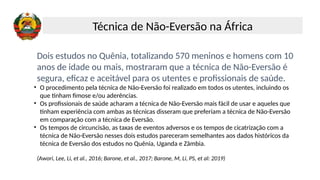 Dois estudos no Quênia, totalizando 570 meninos e homens com 10
anos de idade ou mais, mostraram que a técnica de Não-Eversão é
segura, eficaz e aceitável para os utentes e profissionais de saúde.
• O procedimento pela técnica de Não-Eversão foi realizado em todos os utentes, incluindo os
que tinham fimose e/ou aderências.
• Os profissionais de saúde acharam a técnica de Não-Eversão mais fácil de usar e aqueles que
tinham experiência com ambas as técnicas disseram que preferiam a técnica de Não-Eversão
em comparação com a técnica de Eversão.
• Os tempos de circuncisão, as taxas de eventos adversos e os tempos de cicatrização com a
técnica de Não-Eversão nesses dois estudos pareceram semelhantes aos dados históricos da
técnica de Eversão dos estudos no Quênia, Uganda e Zâmbia.
(Awori, Lee, Li, et al., 2016; Barone, et al., 2017; Barone, M, Li, PS, et al: 2019)
Técnica de Não-Eversão na África
 