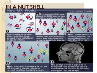 IN A NUT SHELLIN A NUT SHELL
 