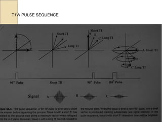 T1W PULSE SEQUENCE
 
