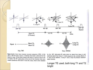 Longer TE used..both long T1 and T2 …
bright
 