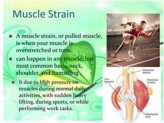 Muscle Strain






A muscle strain, or pulled muscle,
is when your muscle is
overstretched or torn.
can happen in any muscle, but
most common back, neck,
shoulder, and hamstring .
It due to high pressure on
muscles during normal daily
activities, with sudden heavy
lifting, during sports, or while
performing work tasks.

 
