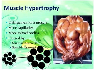 Muscle Hypertrophy
 Enlargement of a muscle
 More capillaries
 More mitochondria
 Caused by
 Strenuous exercise
 Steroid hormones

 