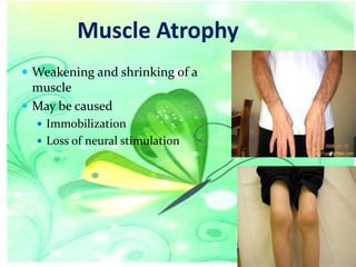 Muscle Atrophy
 Weakening and shrinking of a

muscle
 May be caused
 Immobilization
 Loss of neural stimulation

 