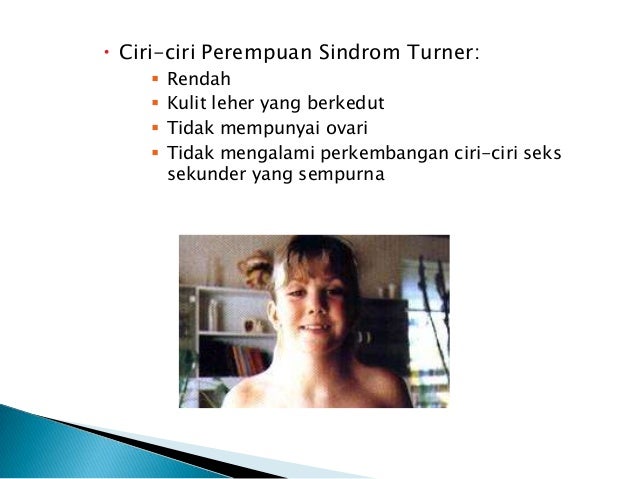 Mutasi dalam Sains Tingkatan 4