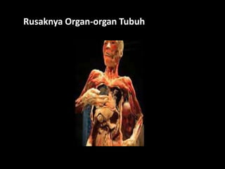 Rusaknya Organ-organ Tubuh
 