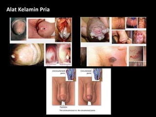 Alat Kelamin Pria
 