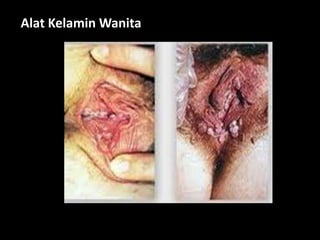 Alat Kelamin Wanita
 