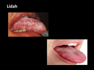 Lidah
 