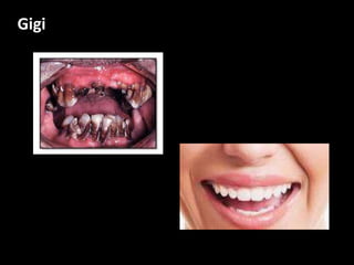 Gigi
 