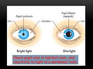 Check pupil size in lighted room, and
reactivity to light in a darkened room.
 