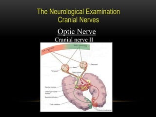 Optic Nerve
Cranial nerve II
 