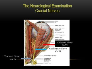Trochlear Nerve
c.n. IV
Oculomotor Nerve
Cn III
Abducens Nerve
Cn VI
 