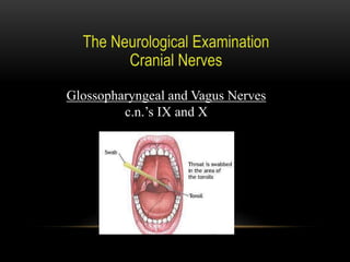 Glossopharyngeal and Vagus Nerves
c.n.’s IX and X
 