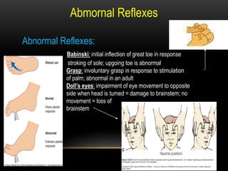 Abmornal Reflexes
Abnormal Reflexes:
Babinski: initial inflection of great toe in response
stroking of sole; upgoing toe is abnormal
Grasp: involuntary grasp in response to stimulation
of palm; abnormal in an adult
Doll’s eyes: impairment of eye movement to opposite
side when head is turned = damage to brainstem; no
movement = loss of
brainstem
 