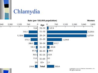 Chlamydia  
