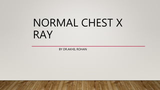 NORMAL CHEST X
RAY
BY DR.AKHIL ROHAN
 