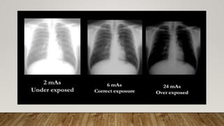 Normal Radiography Normal chest X ray radiography interpretation | PPTX