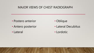 Lordotic View Normal chest X ray radiography interpretation | PPTX