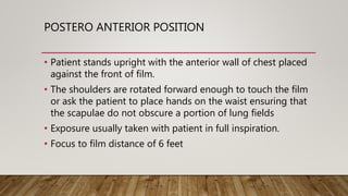 Normal chest X ray radiography interpretation | PPTX