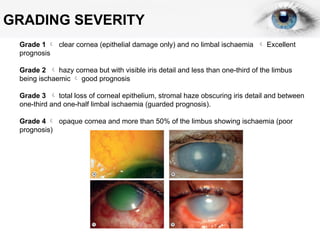 ppt ocular trauma cedera pada mata ppt.pptx