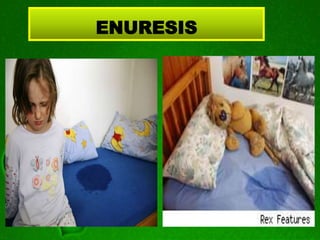ENURESIS
 