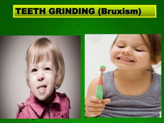 TEETH GRINDING (Bruxism)
 