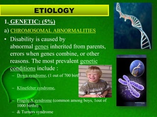ETIOLOGY
1. GENETIC: (5%)
a) CHROMOSOMAL ABNORMALITIES
• Disability is caused by
abnormal genes inherited from parents,
errors when genes combine, or other
reasons. The most prevalent genetic
conditions include :
– Down syndrome, (1 out of 700 births)
– Klinefelter syndrome,
– Fragile X syndrome (common among boys, 1out of
1000 births)
– & Turners syndrome
 