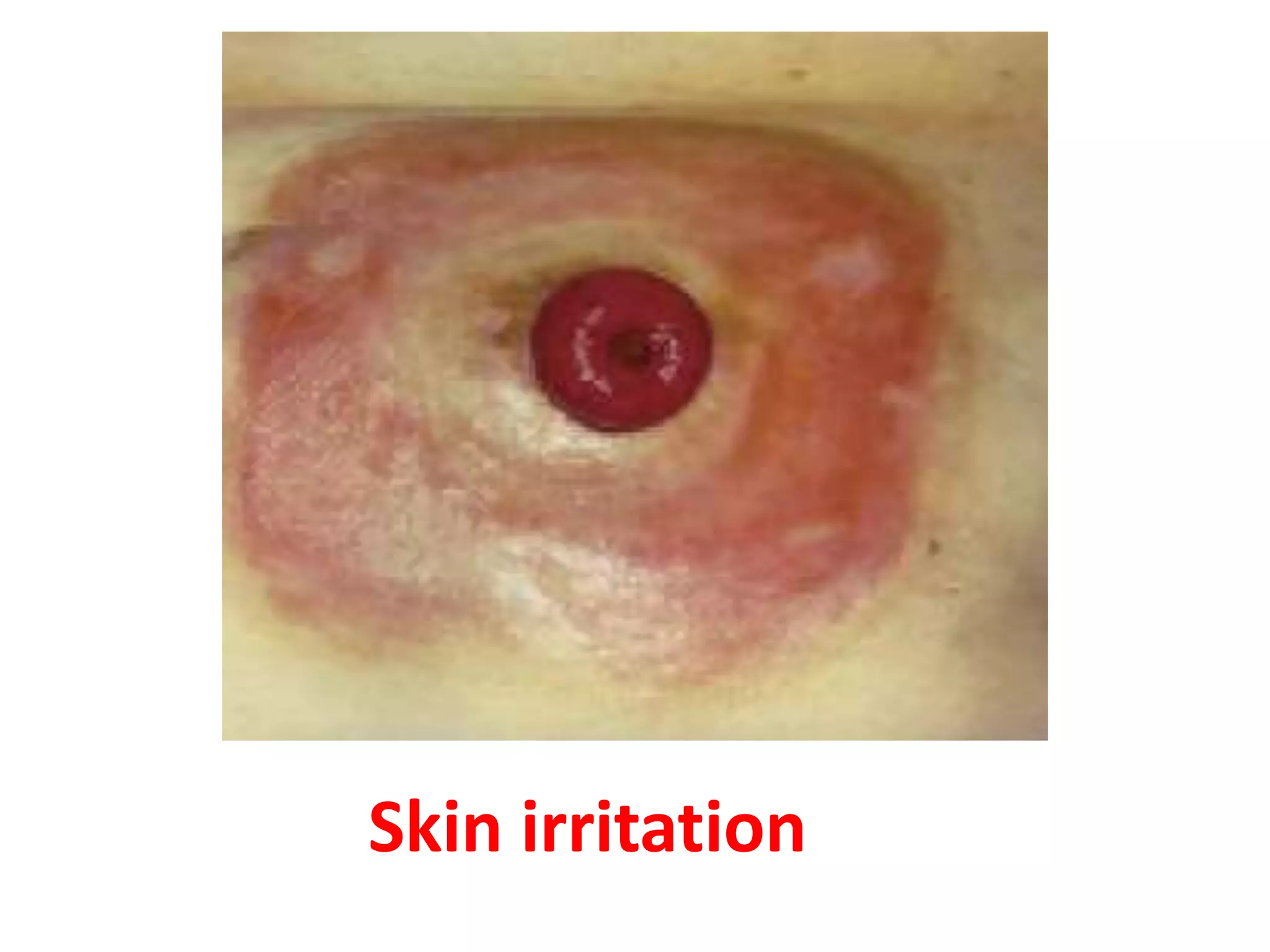 Skin irritation
 