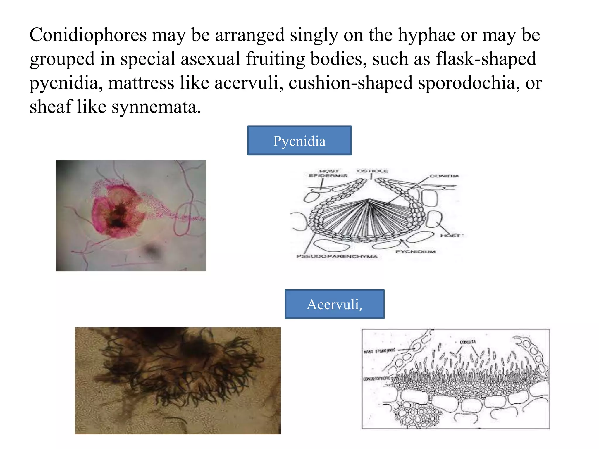 Conidiophores may be arranged singly on the hyphae or may be
grouped in special asexual fruiting bodies, such as flask-shaped
pycnidia, mattress like acervuli, cushion-shaped sporodochia, or
sheaf like synnemata.
Pycnidia
Acervuli,
 