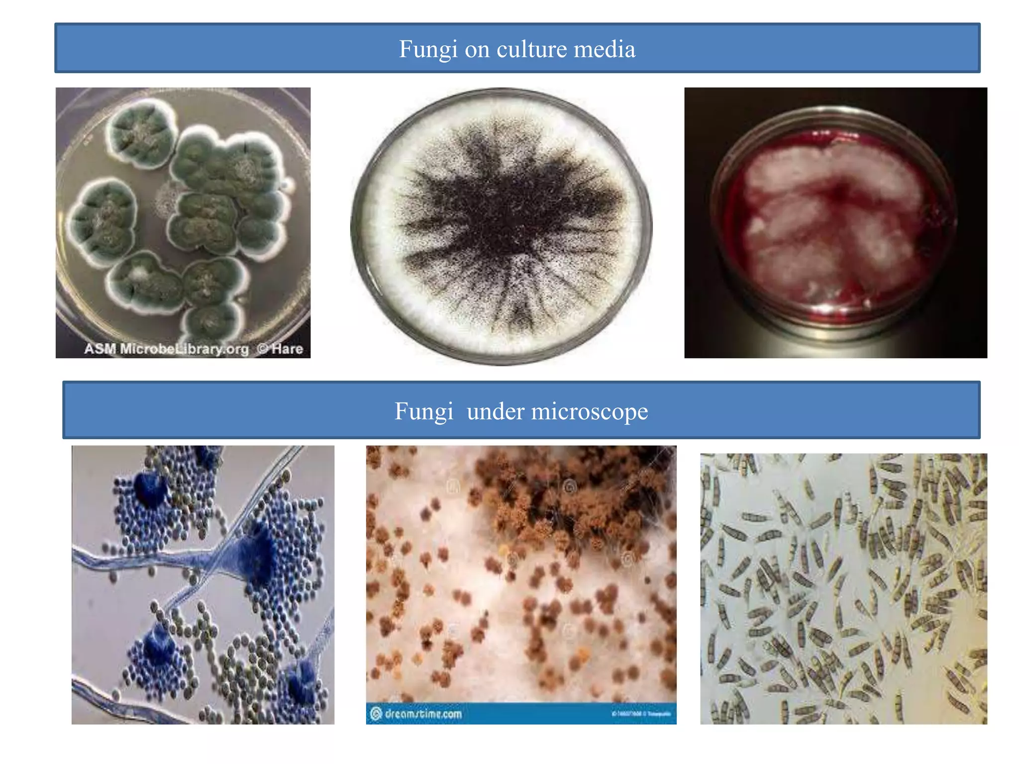 Fungi on culture media
Fungi under microscope
 