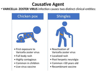 ppt of paediatric chicken pox and tetanus with vignette.pptx