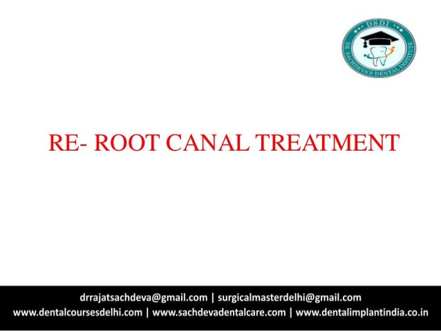 Re Root Canal Treatment Root Canal Treatment Advanced Root Canal Tr