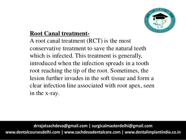 Re Root Canal Treatment Root Canal Treatment Advanced Root Canal Tr