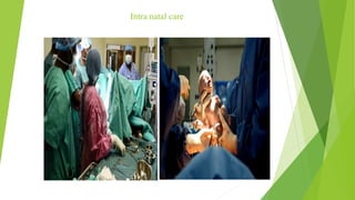 Intra natal care
 