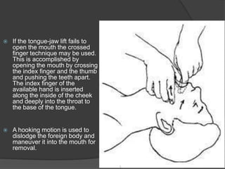 Ppt on cpr | PPT
