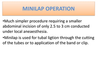 MINILAP OPERATION
•Much simpler procedure requiring a smaller
abdominal incision of only 2.5 to 3 cm conducted
under local aneaesthesia.
•Minilap is used for tubal ligtion through the cutting
of the tubes or to application of the band or clip.
 